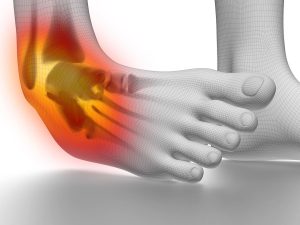 ankle sprains-thumb
